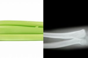 Celer-kosti